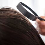 Pantogar: Hair Damage & Hair Recovery