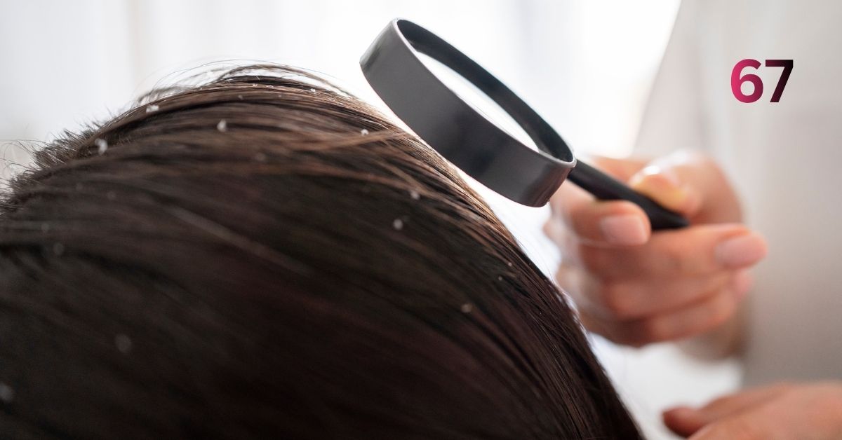 Pantogar: Hair Damage & Hair Recovery